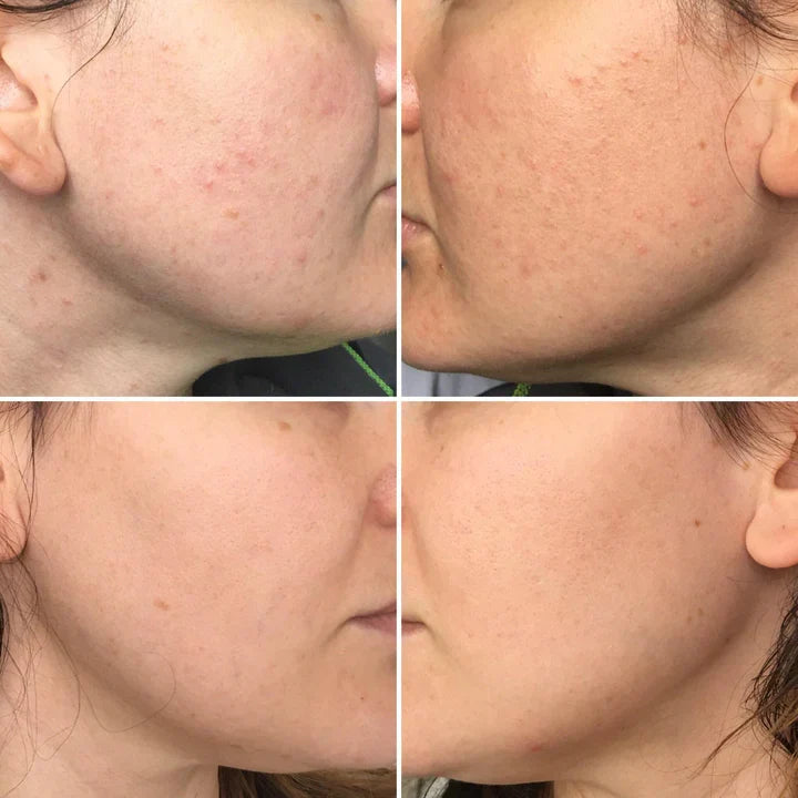 Orange Glow Enzyme Gel