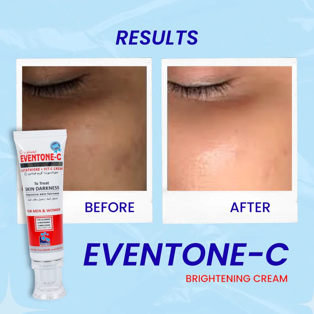 Eventone-C Cream with L-Glutathione & Vitamin C